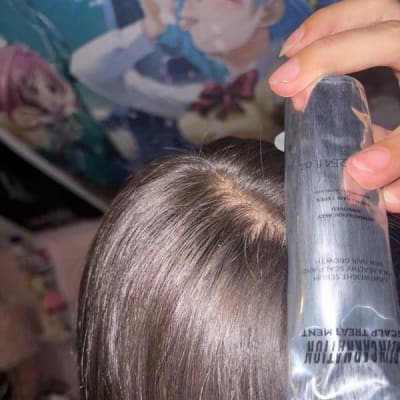 My scalp feels so soft and looks shinier than ever! image
