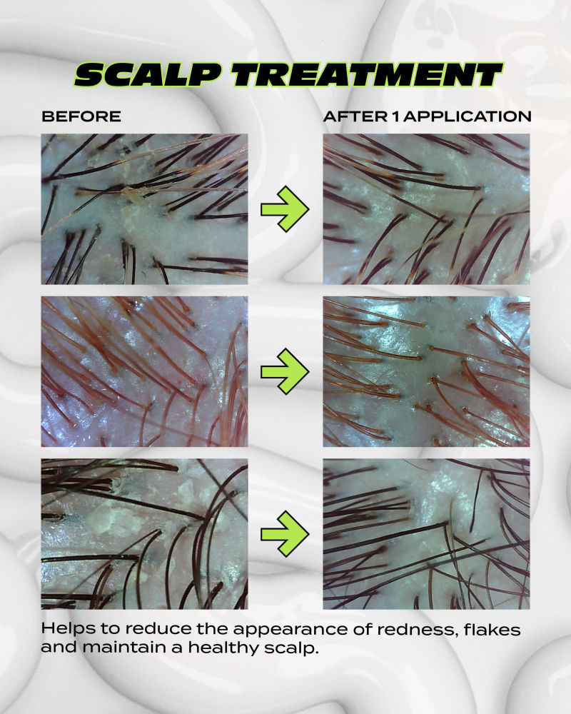 Reincarnation Scalp Treatment product image